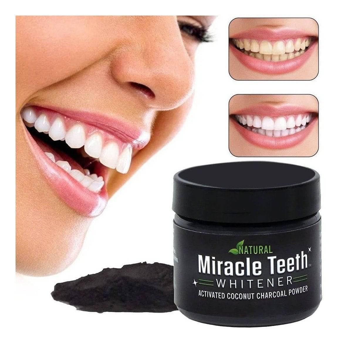 Blanqueador dental + Farol Led de REGALO 🎁