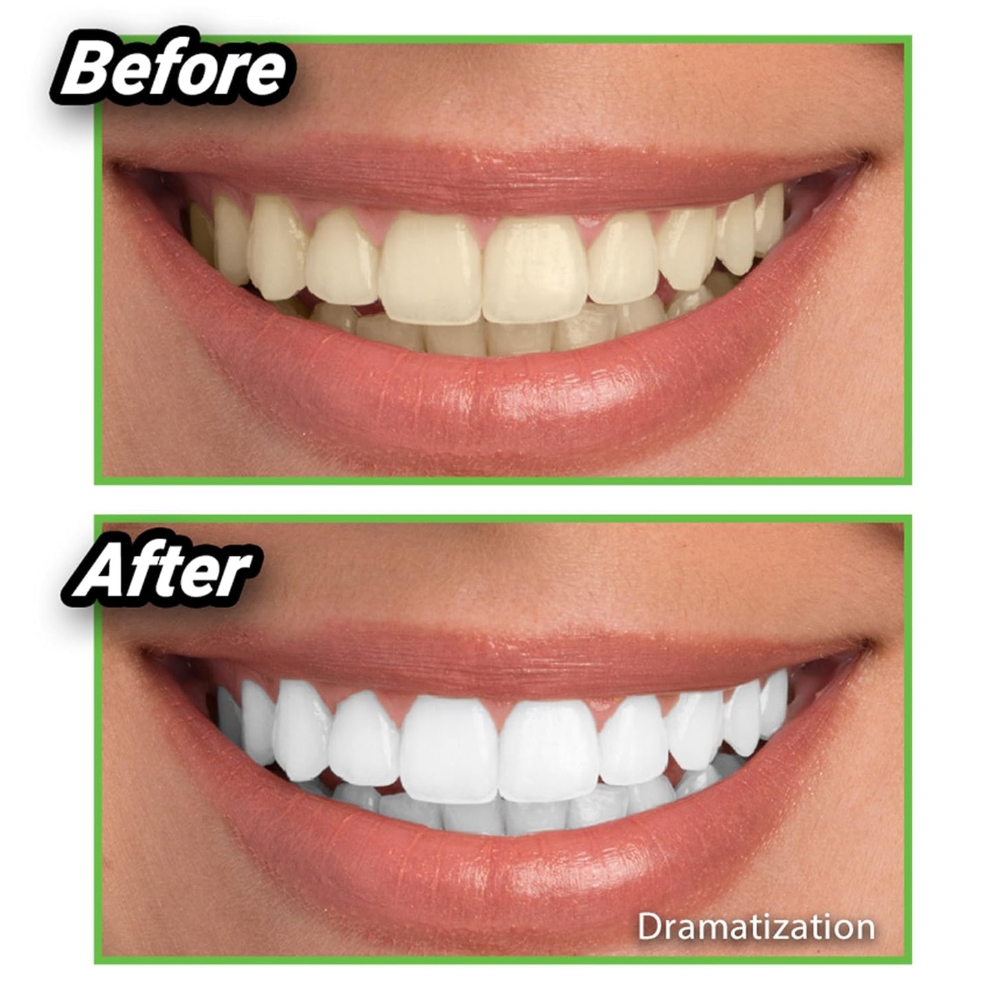 Blanqueador dental + Farol Led de REGALO 🎁